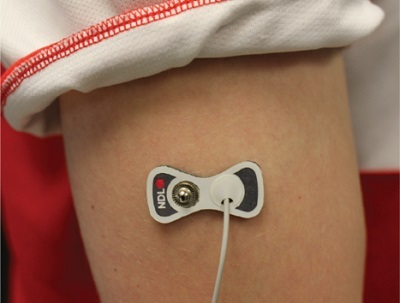 A prototype of a device that can measure interstitial fluid uses microneedles. Credit: Mark Friedel
