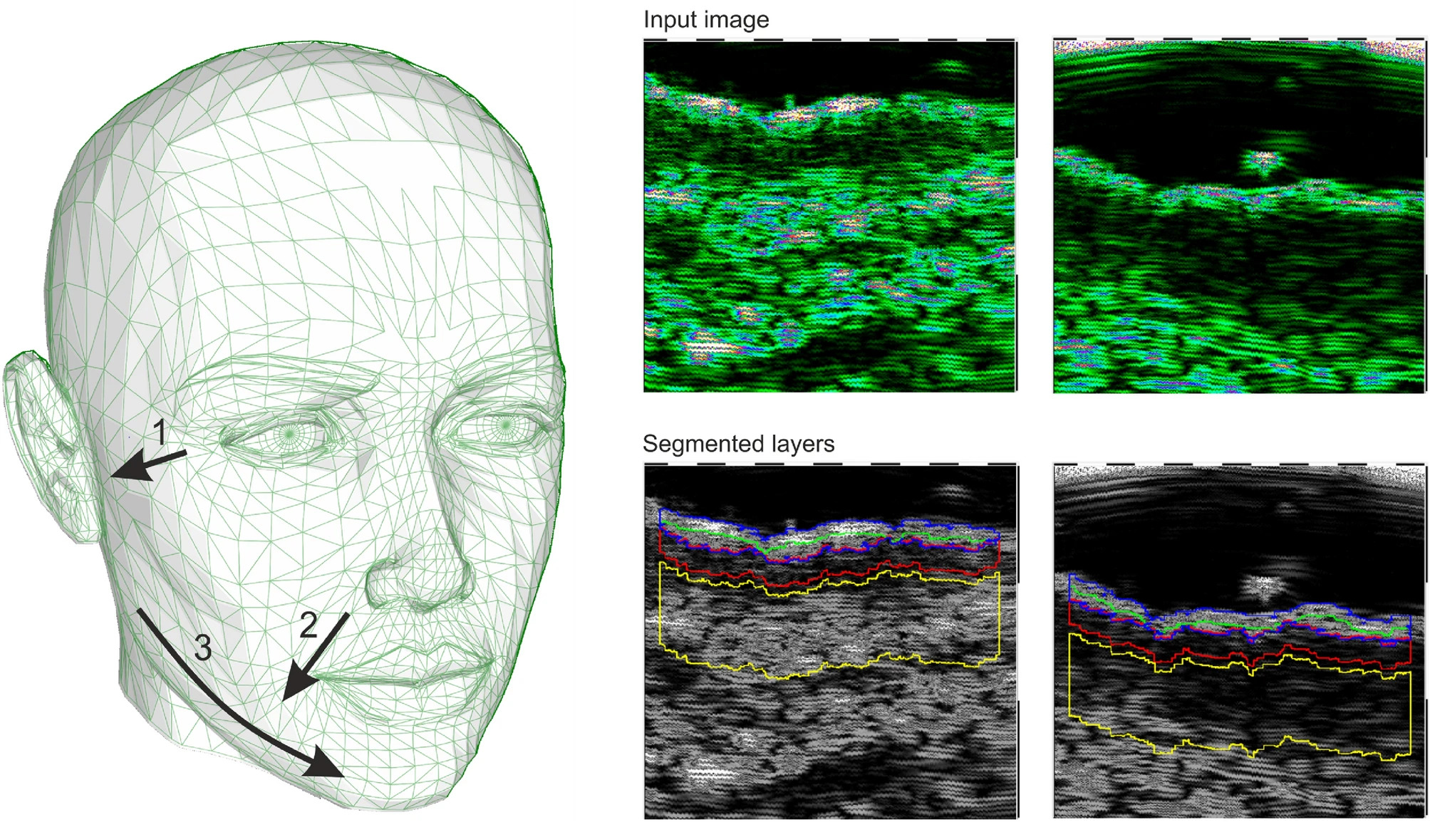 High-frequency-ultrasound-in-anti-aging-skin-therapy-monitoring